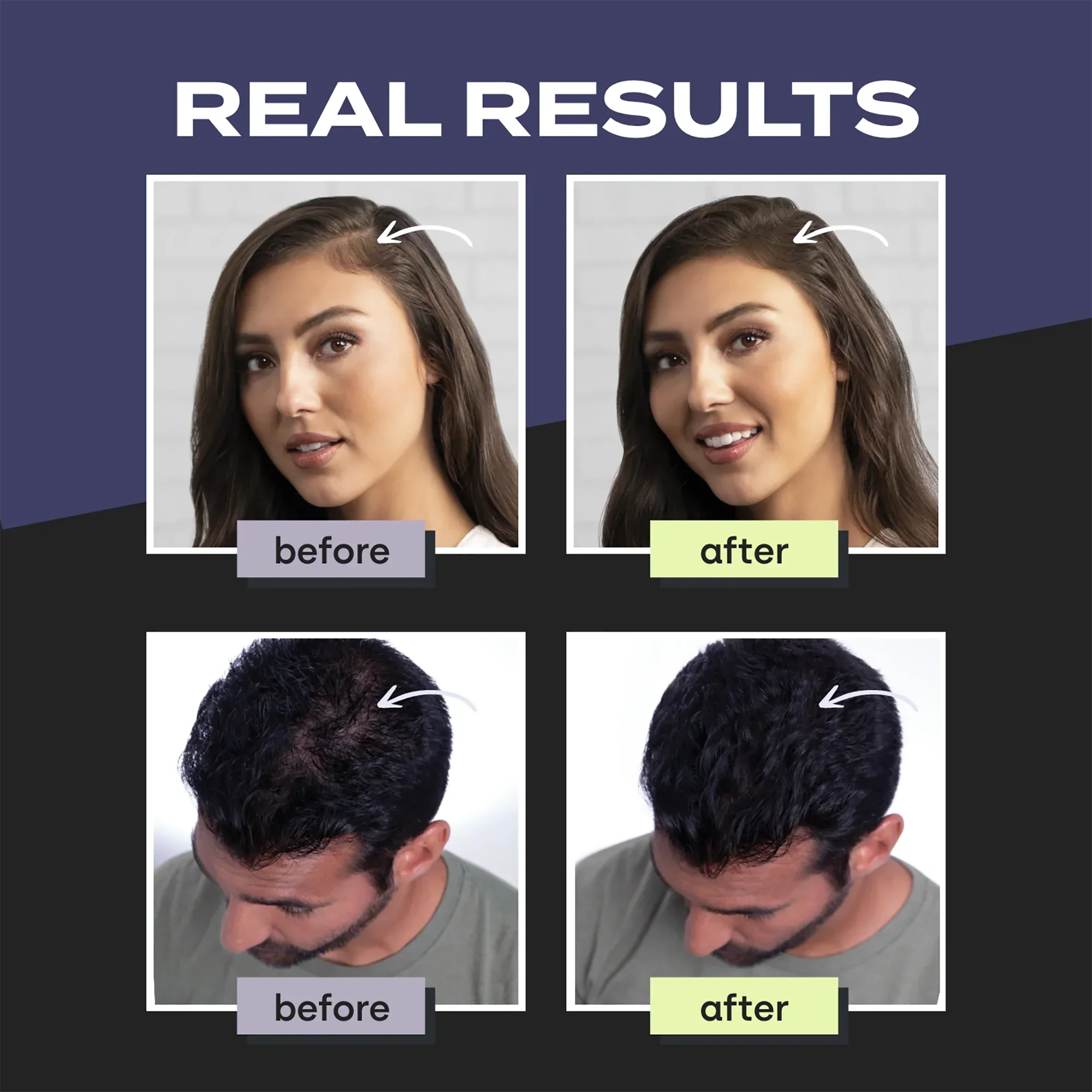 Hair Fiber